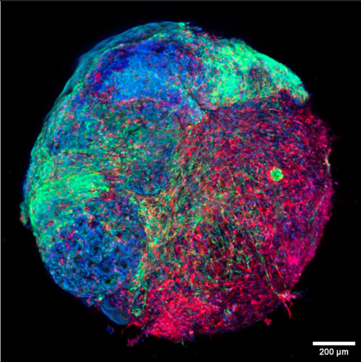 A 3D brain organoid model